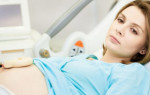 Ангина при беременности: особенности течения и лечения заболевания