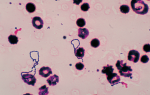 Бактерии стрептококка вириданс (Streptococcus viridans)