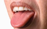 Почему может болеть язык и горло и что необходимо делать