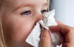 Заложенность носа у ребенка лечение, причины, капли