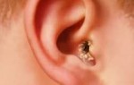 Корки в ушах у человека фото, причины, что делать, как лечить
