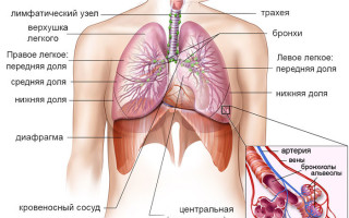 Отличие пневмонии от бронхита в чем разница, признаки и симптомы