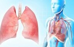 Симптомы и лечение плеврита лёгких