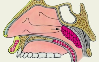 Носоглоточная миндалина: особенности и гипертрофический процесс