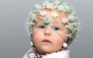 Что нужно знать об электроэнцефалографии (ЭЭГ) у детей