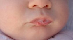 Вязкая слюна во рту у ребенка