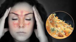 Болит голова от насморка: причины и способы терапии