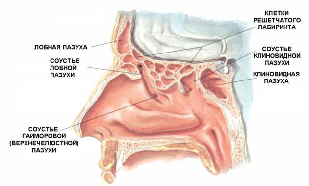 Синусит - заболевание придаточных пазух носа