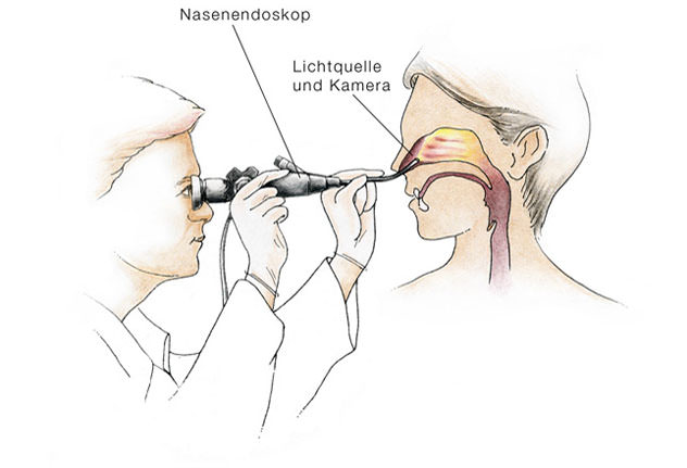 Исследование носа у пациента