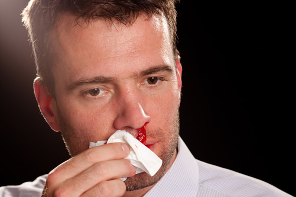 носовое кровотечение при раке носа
