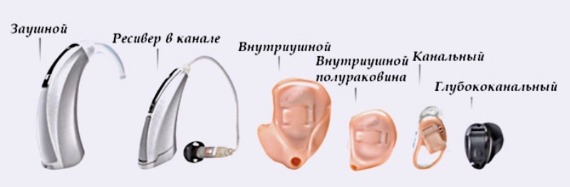 Типы аппаратов для слуха