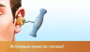 Возможные причины заложенности в ушах
