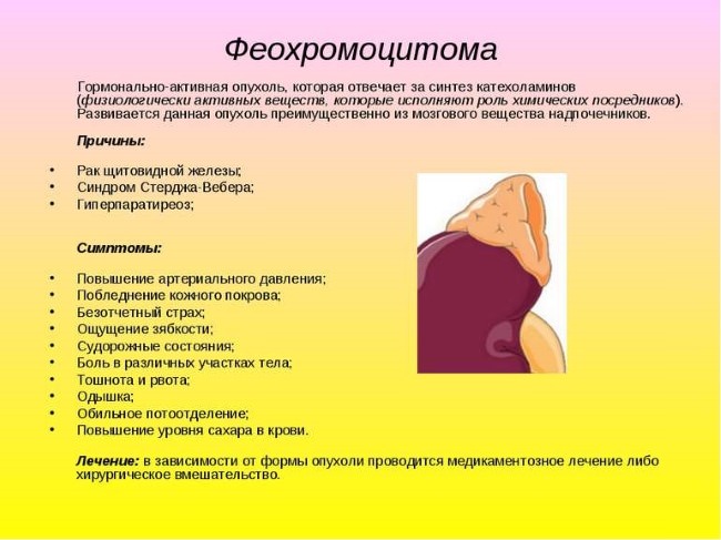 Феохромоцитома