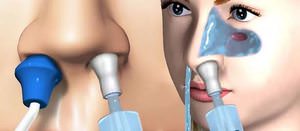 Промывание носа как способ лечения насморка