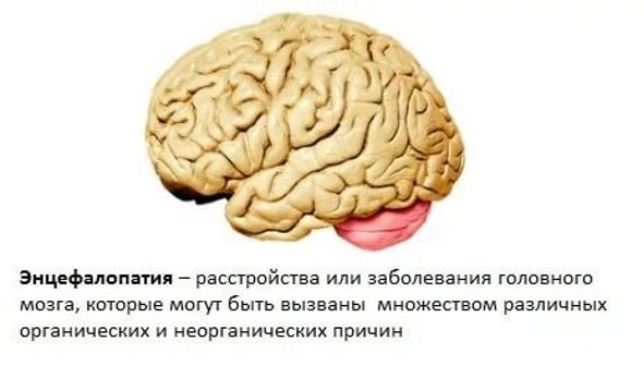 Энцефалопатия головного мозга