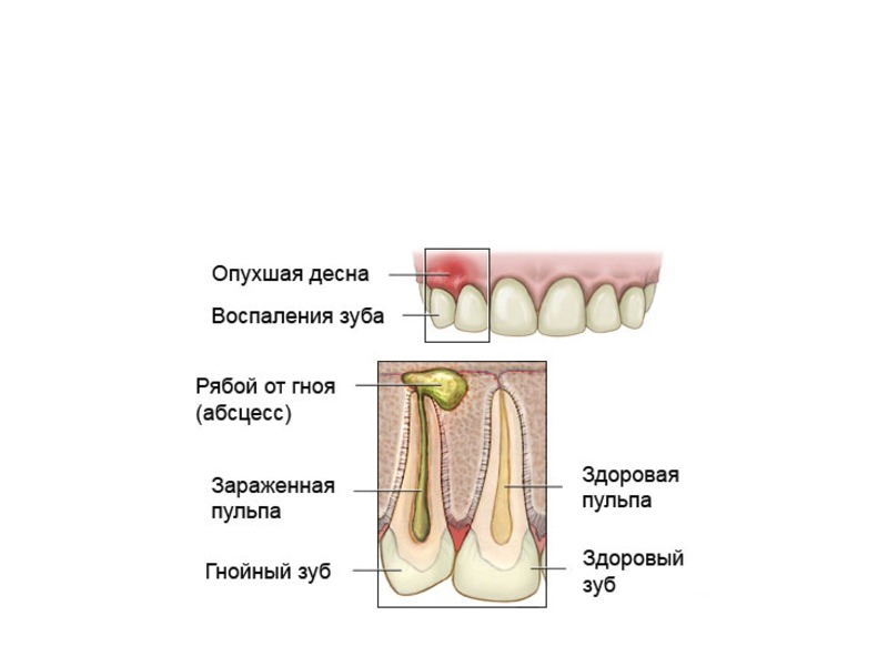 Из-за чего развивается заболевание