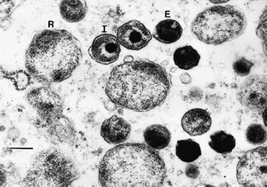 Хламидия под микроскопом - болезнетворный микроорганизм