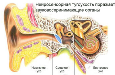 Наиболее распространенные болезни уха