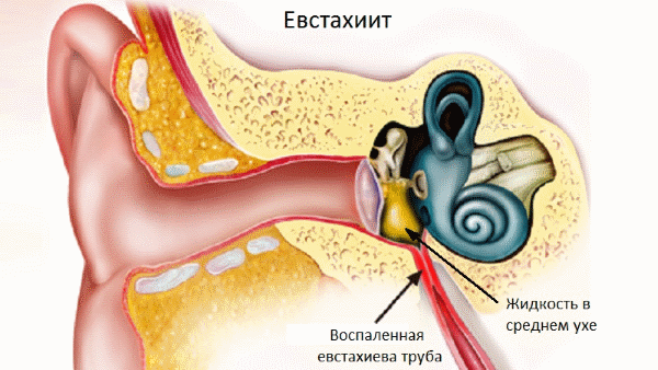 Евстахиева труба